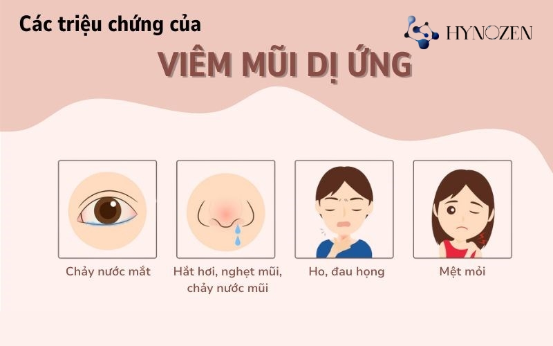 Biểu hiện của viêm mũi dị ứng