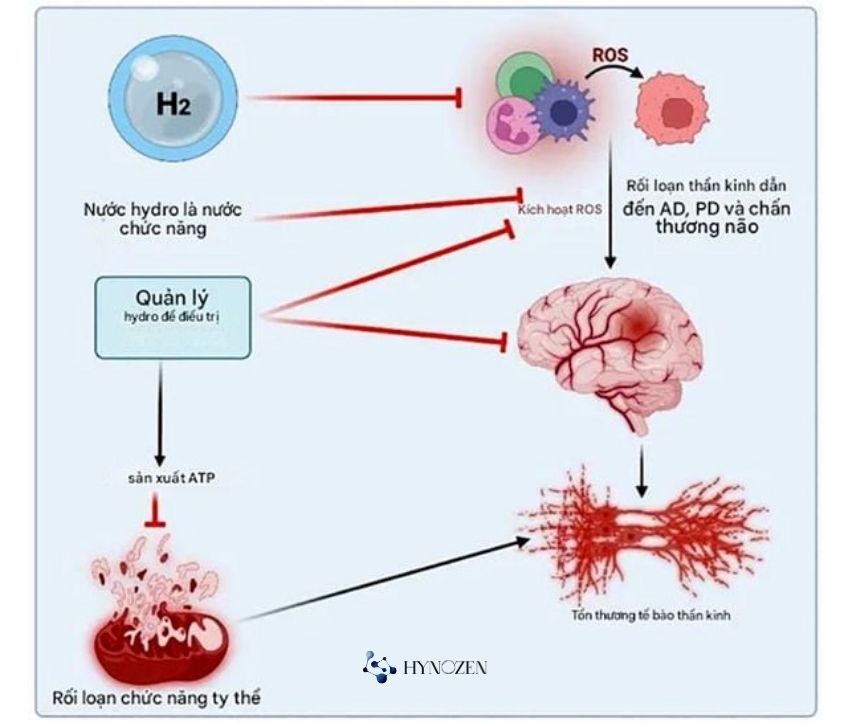 Nguyên nhân bệnh alzheimer