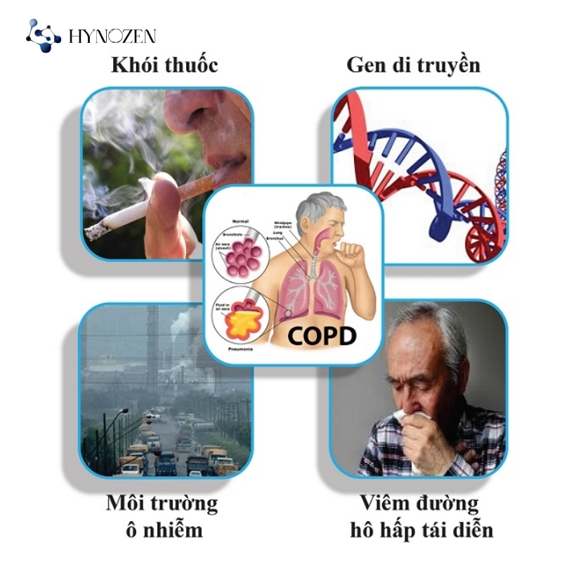 Nguyên nhân gây COPD